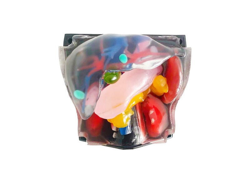 Abdominal Intraoperative & Laparoscopic Ultrasound Diagnosis Model (Transparent)