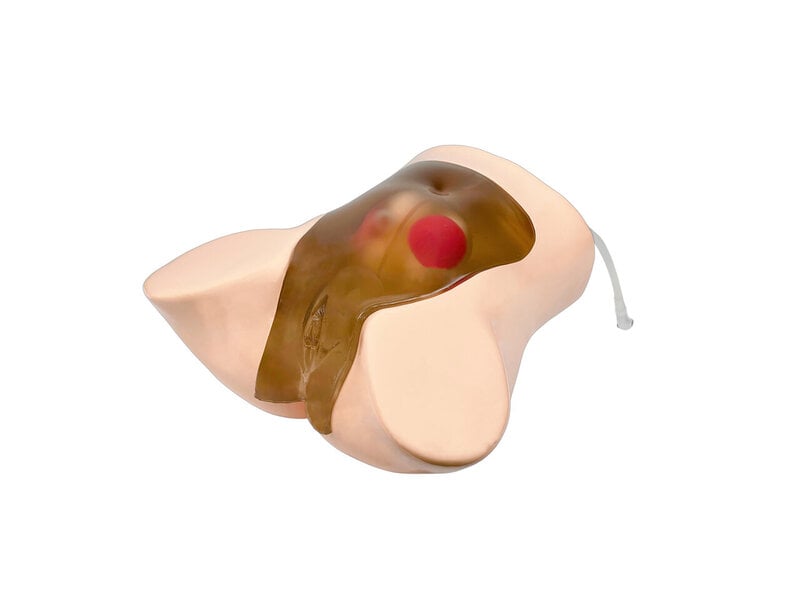 Amniocentesis 16W twin Transparent
