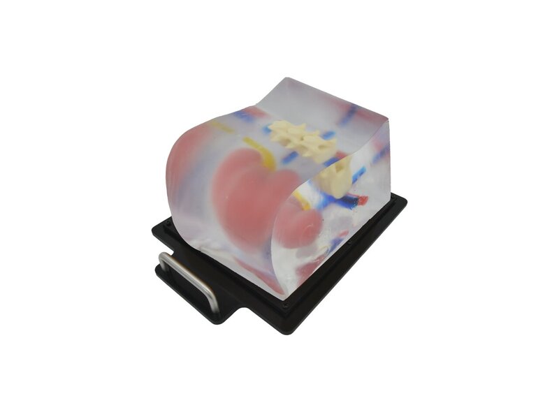 Renal Mass Biopsy Ultrasound Model (Transparent)