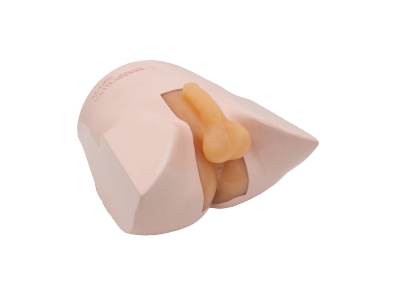 Prostate Mass Biopsy Ultrasound Model (Skin Tone)