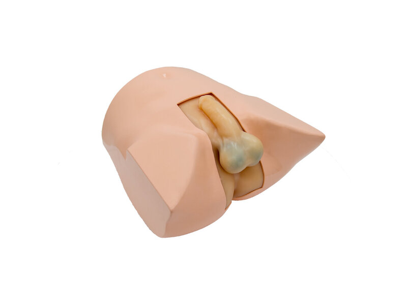 Scrotum And Prostate Ultrasound Examination Model (Skin colored)